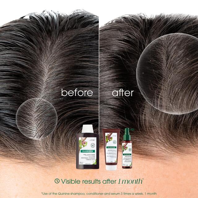 Klorane Shampoo with Quinine and Organic Edelweiss for Thinning Hair   200ml - McGrocer